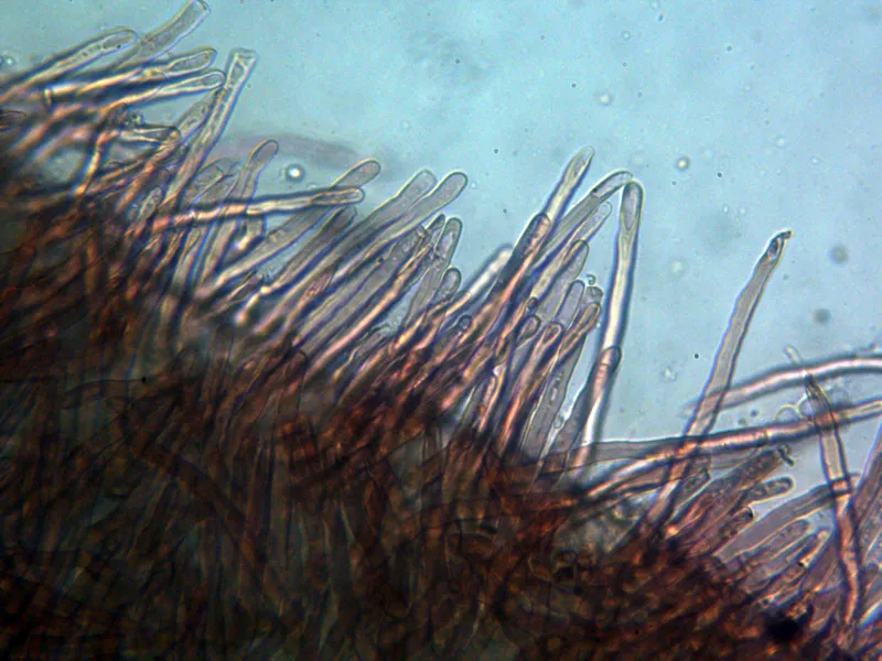 Auricularia auricula-judae 11 - Pilosidad x 400 1